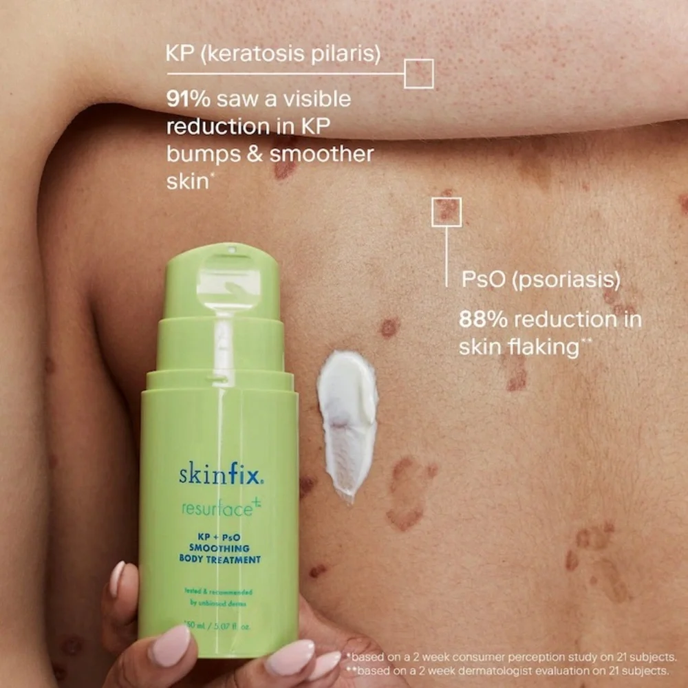 Skinfix Resurface+ KP+ PsO Smoothing Body Treatment
